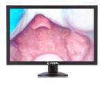 Battery Portable Video Laryngoscope For Adult / Pediatic / Neonate 640*480