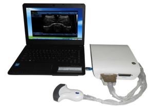 Wholesale High Resolution Portable Ultrasound Scanner 3D B / W Ultrasound Box With USB Port from china suppliers
