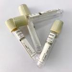 Disposable Glucose Blood Tube Sodium Fluoride Potassium Oxalate Additive