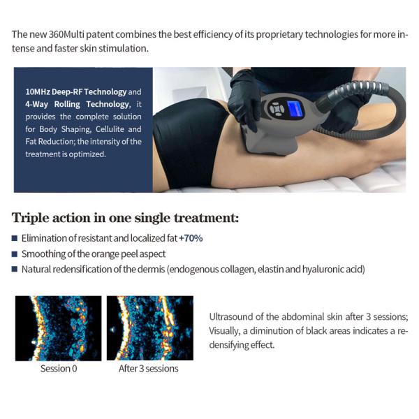 6 In 1 Infrared Body Slimming Machine Vacuum Rf Roller