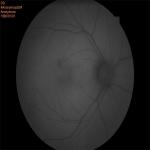 FAF Non Mydriatic Fundus Camera Optical Retinal Imaging