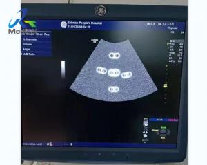 Wholesale GE Logiq E9 Display A Virtual Image At Startup Ultrasound Machine Repair Replace GTX2.3 from china suppliers