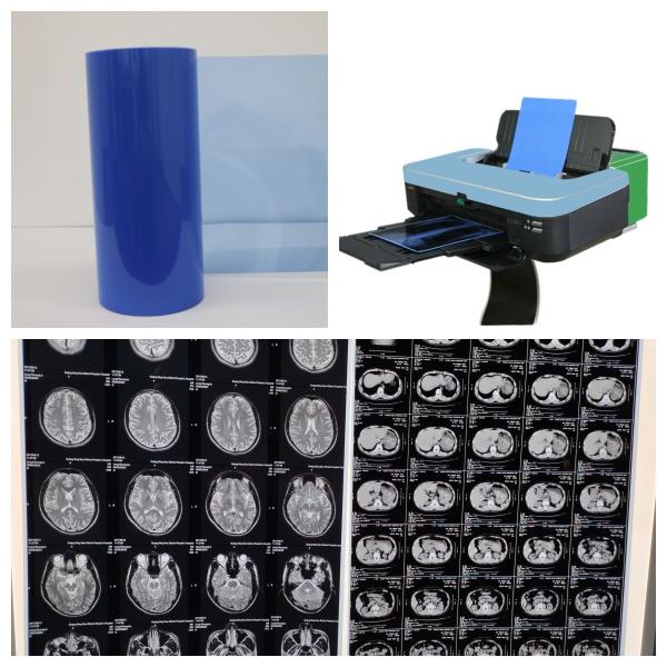 17inch Inkjet X Ray Film For Medical Imaging 8x10 10x12 11x14 14x17 A4 A3 A3+