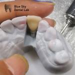 Biocompatibility Studies Implantation Scenarios Steam Sterilization