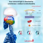 Parkinson Alzheimer NIR Light Therapy Devices Stroke TBI PBM Photobiomodulation