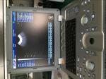 Medical Ultrasound Machine Portable Ultrasound Scanner 4d Ultrasound Equipment