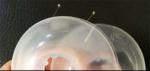 Customized Hospital Medical Device Contract Assembly For Medical Components