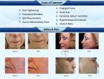 Hot selling face lifting Fractional RF Microneedle Machine