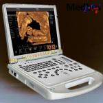 Ce Approved Medical Portable 4D Color Doppler Ultrasound Scanner