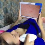 50 Times 200 Times Facial Lamp Reveal Skin Analysis Machine