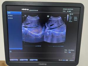 Wholesale Repair Mindray C5-2E DC-70 Convex OB/GYN Probe C5-2E from china suppliers