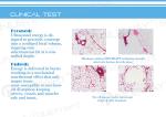 Wholesale Distributors Most Advanced HIFU Machine Liposonix Slimming