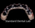 Titanium Full Zirconia Bridge Dental Translucency On Implant Bar