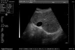 Medical Home Pregnancy Ultrasound Machine DRF RDA Imaging USB Port