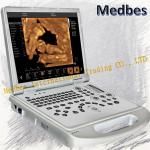 Portable Ultrasound Machine Doppler Ultrasonic Diagnostic E2 Sonoscape Price