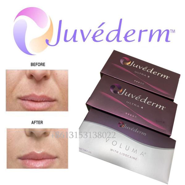 Juvederm Hyaluronic Acid Facial Filler Long Lasting Ultra3 Ultra4 Voluma