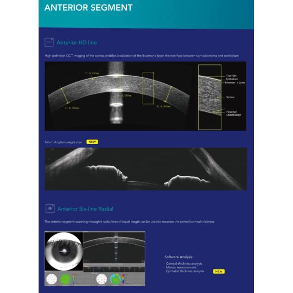 factory price hot selling Advanced OCT Ophthalmic OCT Optical Coherence Tomography
