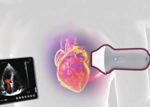 Wholesale PDI WiFi Wireless Portable Ultrasound Scanner 128 Element from china suppliers