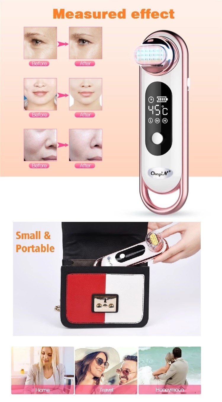 FCC ABS Shell Deep Cleaning 10W RF Skin Rejuvenation Instrument
