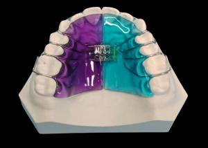 Wholesale Removable Expander for Effective Orthodontic Treatment and Smile Enhancement from china suppliers