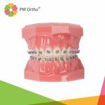 FDA Dental Orthodontic Passive Self Ligating Brackets