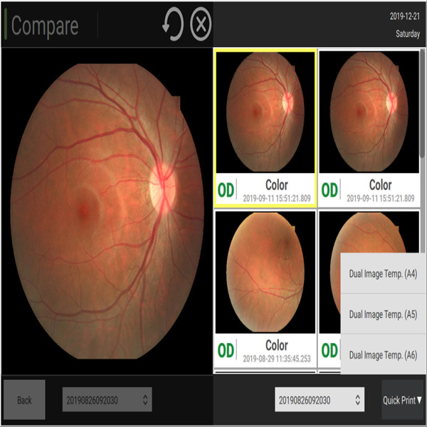 Double Dots Auxiliary Automatic Fundus Camera 60 Lp / Mm Digital Retinal Imaging