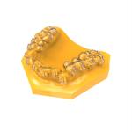 Dental 3D Printing Transparent Orthodontic Bracket Adhesive Guide UV Resin