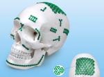 Orthopedic Maxillofacial Implants L Shaped Plates Type I 4mm 5mm 6mm