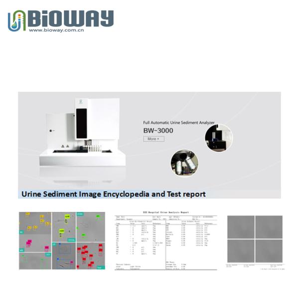 BIOWAY BW-3000 Urine Sediment Analyzer, Full Automatic
