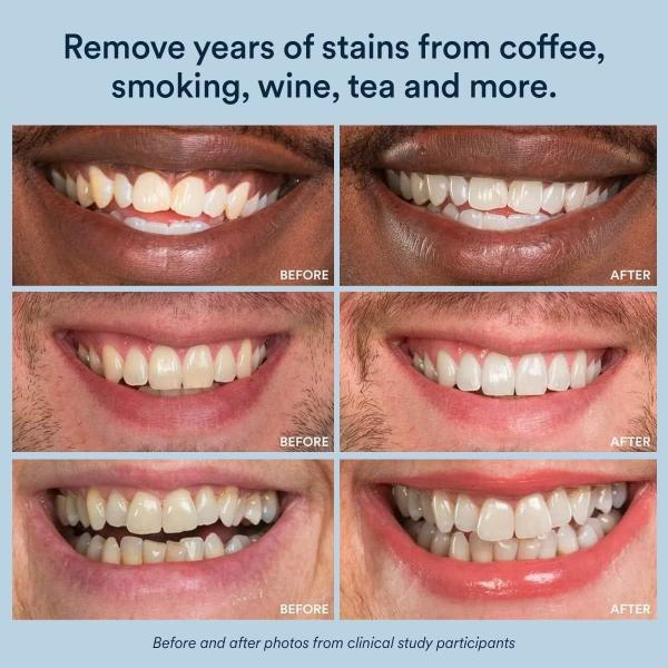 8% Hydrogen Peroxide Teeth Whitening Strips With Nano Hydroxyapatite 28 Strips Mint