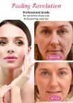 Skin Exfoliating Serum 15% Peeling Solution Professional Grade Skin Peeling