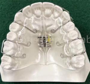 Wholesale State-Of-The-Art Orthodontics Appliance Expanding Retainer Customizable from china suppliers