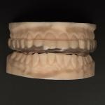 Clear Hard Soft Orthodontic Night Guard Breathability Heavy Duty Protection