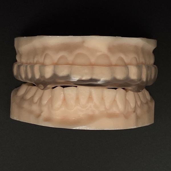 Clear Hard Soft Orthodontic Night Guard Breathability Heavy Duty Protection