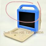 Medbes Full Digital Compact Color Doppler Pregnancy Scanner Ultrasound Machine