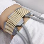 Extracorporeal Shock Wave Cryolipolysis Fat Freezing Machine