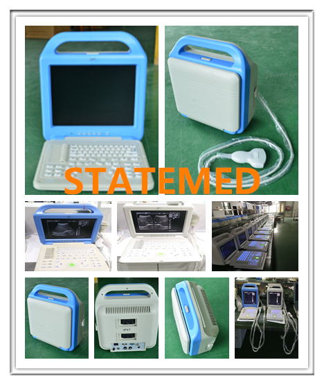 Mobile Ophthalmic Ultrasound Machines , B Ultrasound Scanner Stable Performance