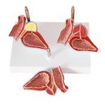 Human Anatomy PVC Simulation Human Pathology Prostate Model For Medical