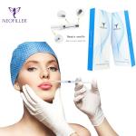 Wrinkle Removal Hyaluronic Acid Based Dermal Fillers 1ml Hyaluronic Acid Lip