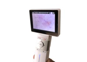 Wholesale Professional Ear Skin Throat Camera Digital Video Otoscope With 1920 x 1080 Pixels from china suppliers
