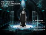 Hot selling technology picosecond Laser tattoo and pigmentation removal
