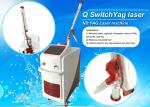 Stationary Q Switch Laser Treatment For Pigmentation / Tattoo Temoval Beauty