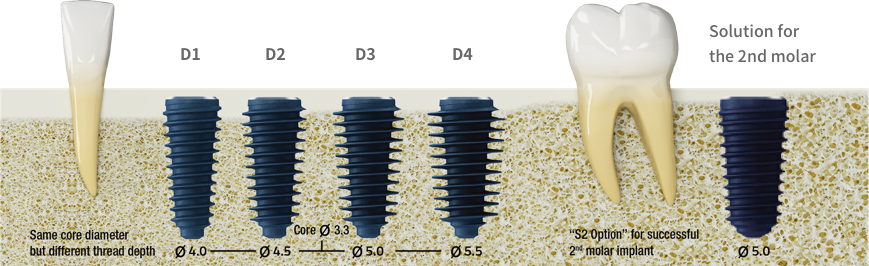 MegaGen ANYRIDGE High Stability Dental Implant Titanium PreMilled Blank 14mm