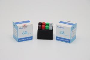 Wholesale H1N1 Rabies Virus RT PCR Test Kit Collection IVD Super Sensitive For Hospital from china suppliers