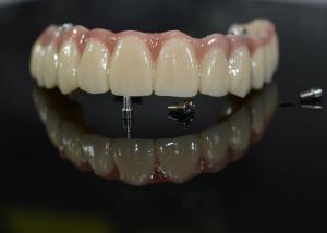 China Zirconia Dental Crown: Natural-looking Teeth, Durable & Secure on sale