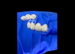 Wieland Zenostar Ceramic Crown Bridge High Precision for Durable and Natural