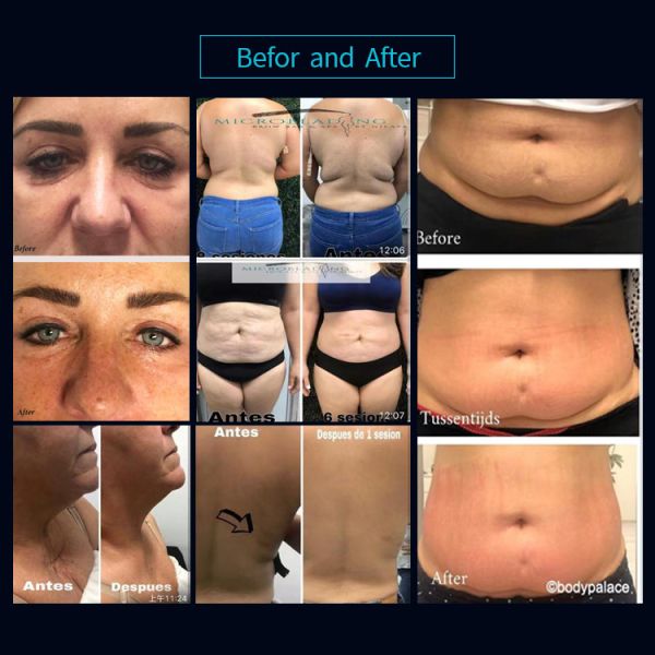 6 In 1 Vacuum Cavitation Slimming Machine Continuous Working For Body Shaping