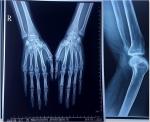 14x17 laser x-ray film FUJI DI-HL (14x17") / (35x43cm) Medical Laser Film fuji